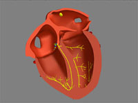 Herzmodell - Schnittansicht